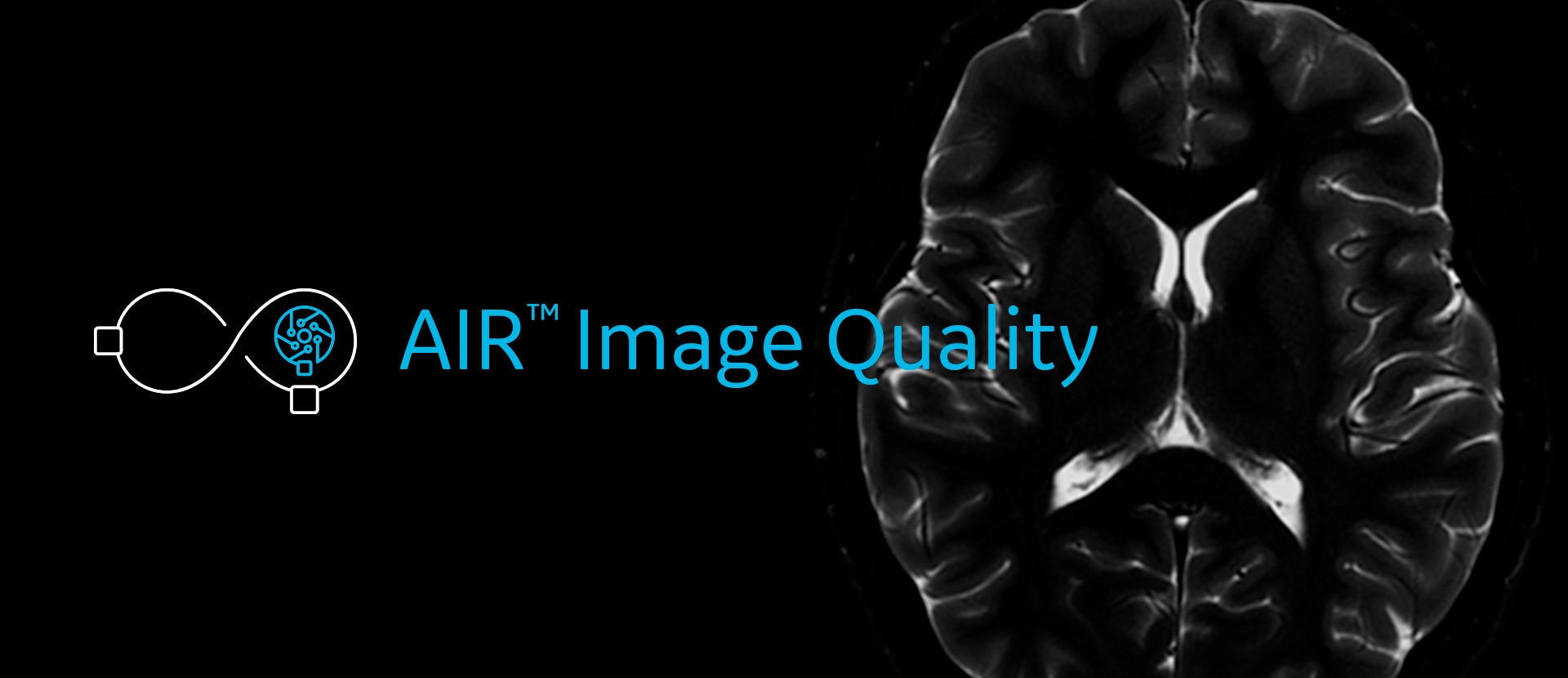 Calidad de imagen en exámenes neurológicos