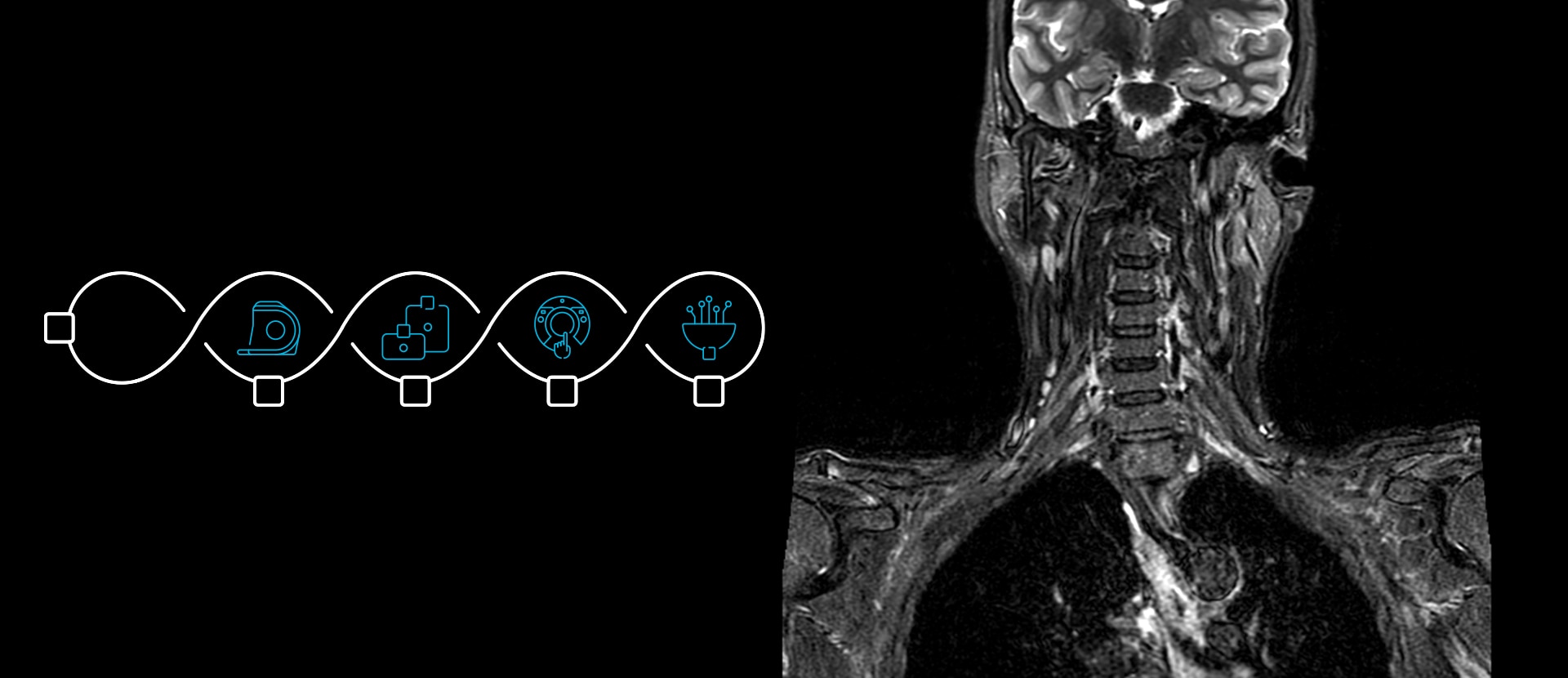 Imagen Resonancia magnética con  AIR™ Technology