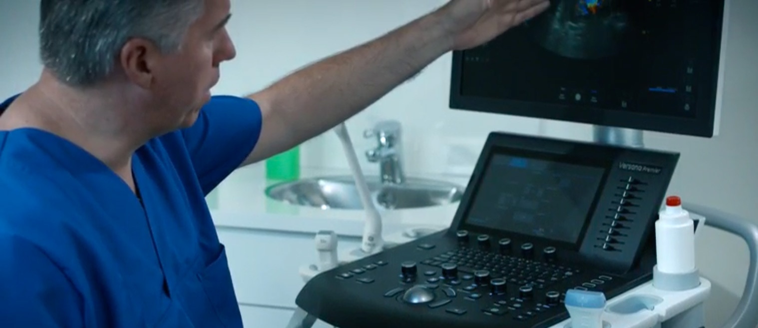 Versana Premier-Ecógrafo portátil