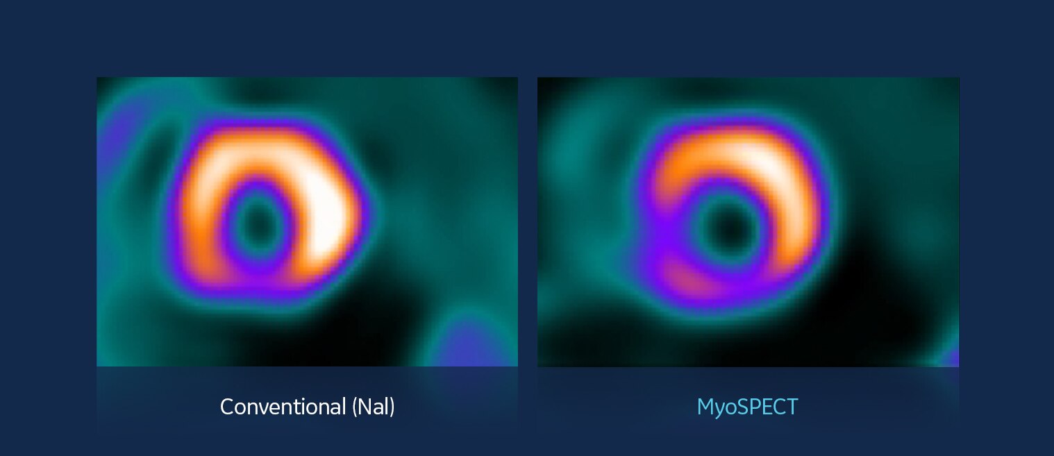 GEHCMyoSPECTPWPImageQualityImage1