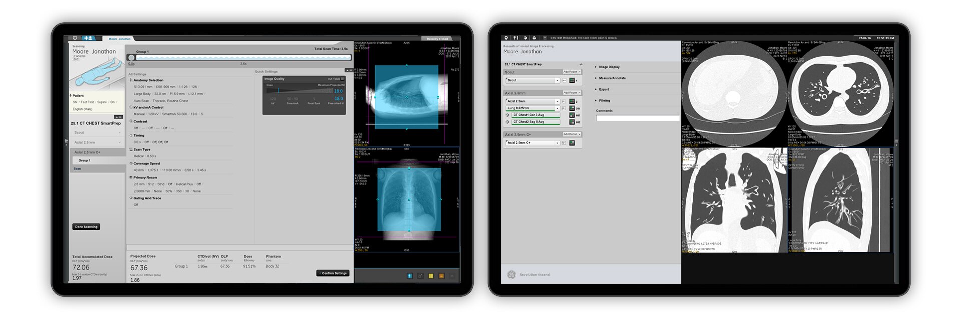 GEHCRevolutionAscendUserInterfaceImage1