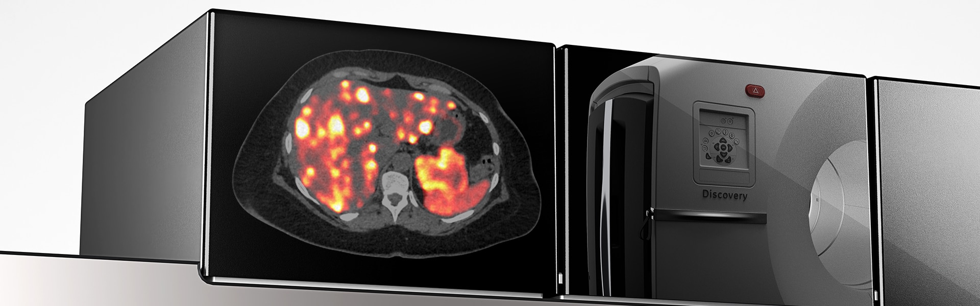 Imágenes PET digitales